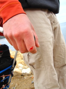 Les mains sont exposées lorsque l'on tracte dans les zones brouissailleuses, du coup une petite coupure sur le doigt