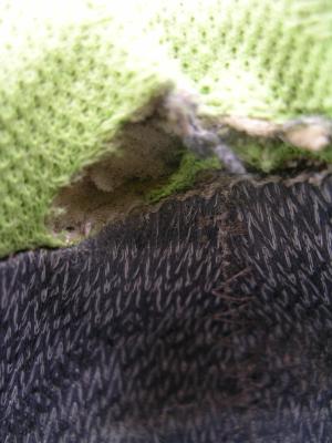 Déchirure des tissus à l'insertion du tendon d'Achile
