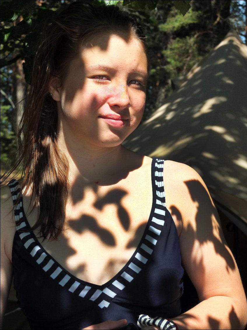 Tes brûlures évoluent d'une manière rassurante et tu apprends qu'il faut les protéger des rayons du soleil, et donc te contraindre à te baigner uniquement dos au soleil.
Tu n'as pas envie que je te prenne en photo dans cet état mais je t'explique que ce n'est pas anodin et qu'il faudra pouvoir illustrer ce qui t'arrive quand nous raconterons ce voyage.