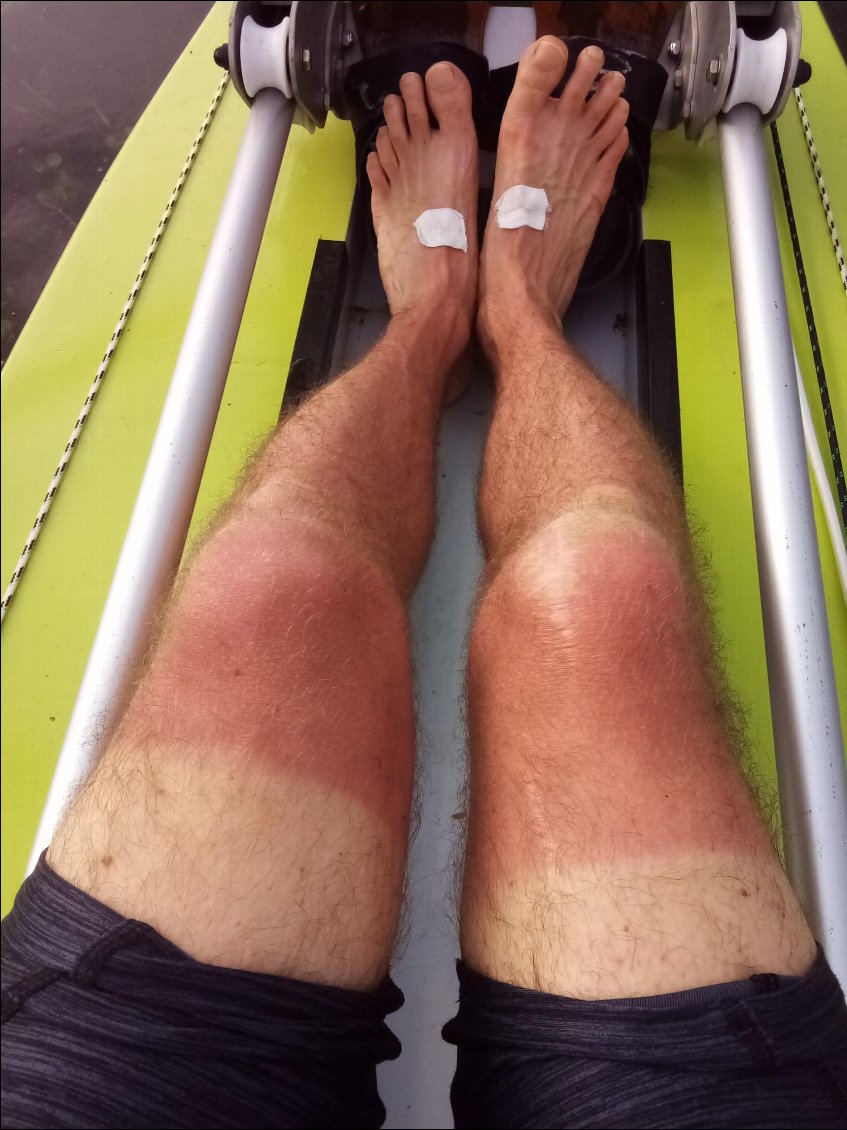 Il a fait grand soleil. Aïe ouille !!