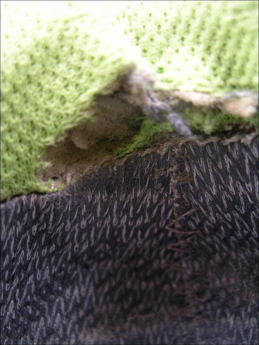 Déchirure des tissus à l'insertion du tendon d'Achile